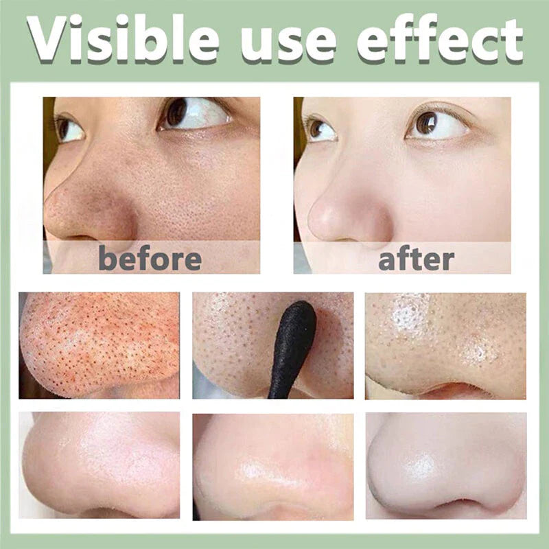 Máscara Stick Chá Verde Anti-Cravo e Acne Hidratante Facial